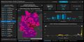 Der COVID-19-Dashboard des Robert-Koch-Instituts - hier ein Screenshot mit den tagesaktuellen Fällen aus der Kreisfreien Stadt Fürth - die sog. Omikron-Welle hat Deutschland erreicht, 30. Jan. 2022